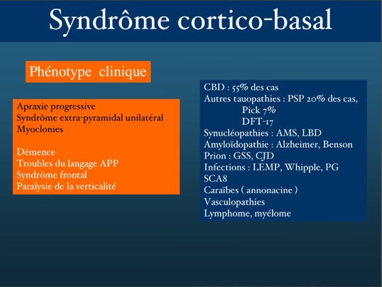 sdcorticobasal.jpg