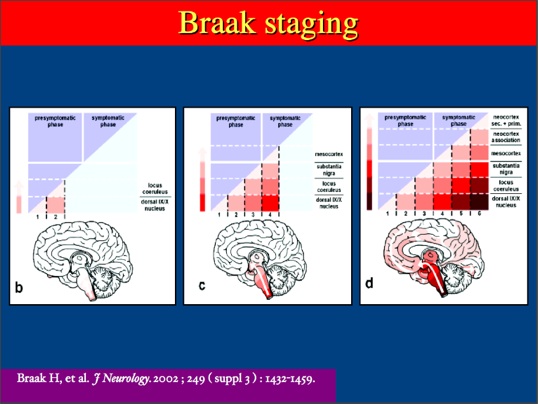 braakstaging.jpg