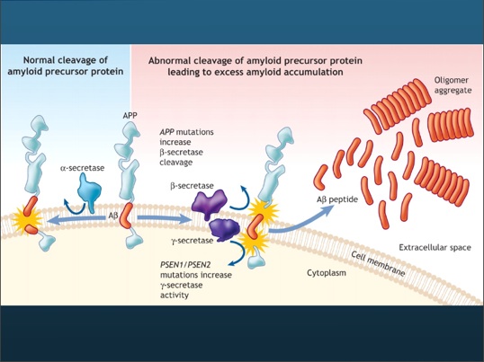 amyloidenature.jpg