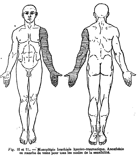 Charcot12.jpg