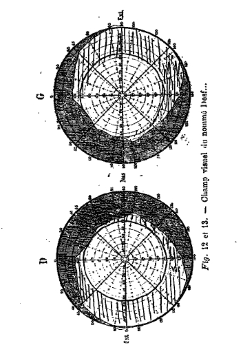 Charcot13.jpg