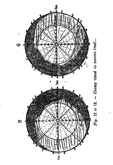 charcotchampvisuel.jpg