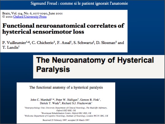 neuroanatomiehysterie.jpg